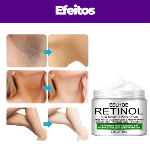 EELHOE RETINOL / Creme Hidratante